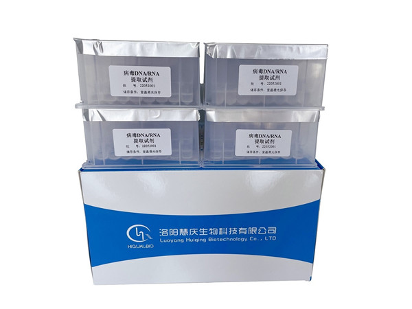 磁珠法核酸提取試劑盒的選購要求有哪些？